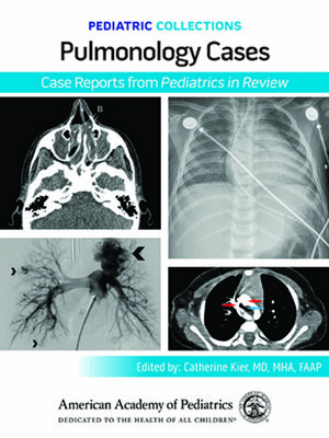cover image of Pulmonology Cases